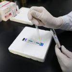 Kasus infeksi baru HIV